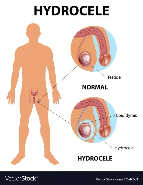 Medical poster showing different between male Vector Image