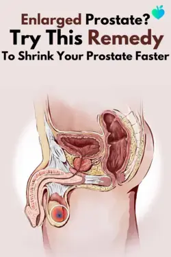 Enlarged Prostate? Try This Remedy To Shrink Your Prostate Faster