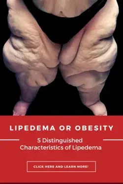 5 Distinguished Characteristics of Lipedema Over Obesity