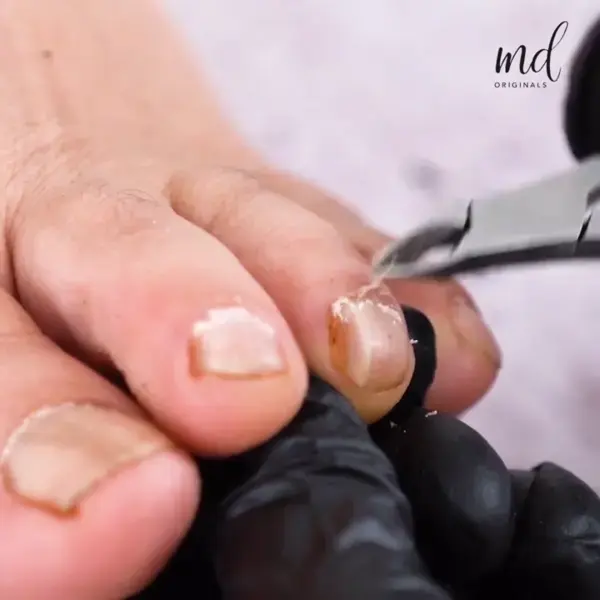 PEDICURE TRANSFORMATION 