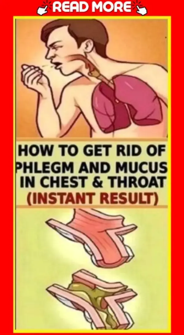 HOW TO GET RID OF PHLEGM AND MUCUS IN CHEST & THROAT (INSTANT RESULT)