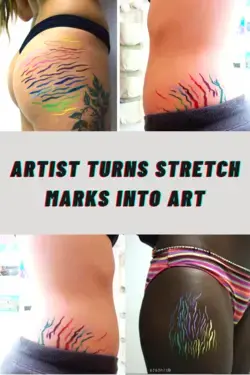 Artist Turns Stretch Marks Into Art 