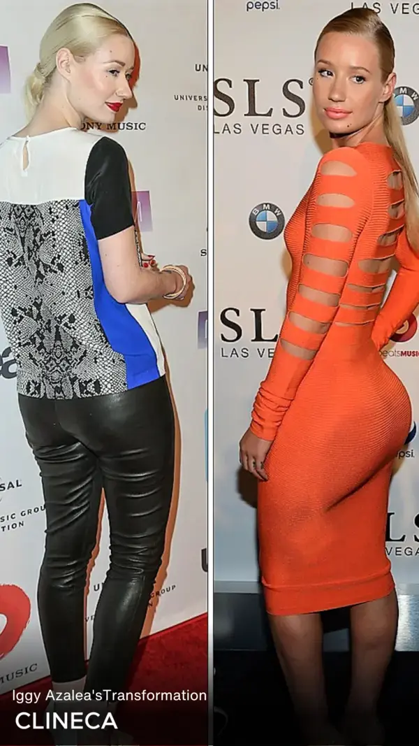 Iggy Azalea Before and After