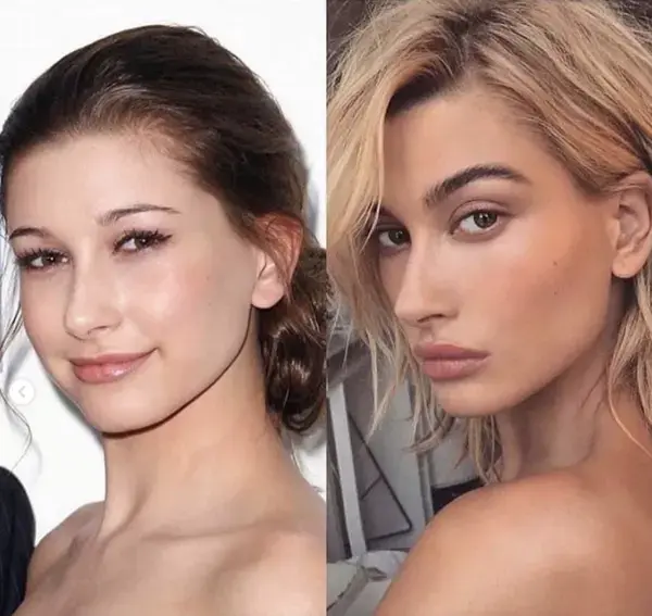 Hailey Bieber denies she has had plastic surgery