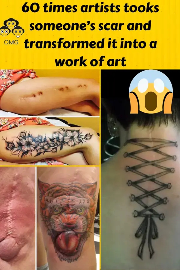 60 times artists tooks someone’s scar and transformed it into a work of art