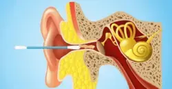 Après avoir regardé cela, vous renoncerez une fois pour toutes à utiliser des cotons-tiges pour vos oreilles !