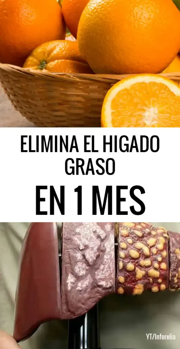 Como eliminar la grasa del HIGADO graso en 1 MES con este Jugo Curativo
