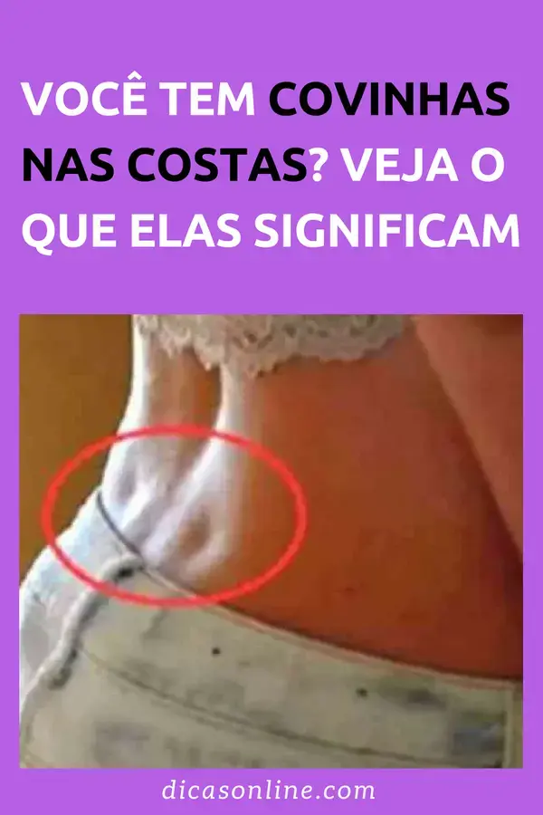 O que significa ter covinha nas costas?