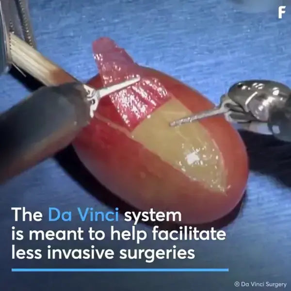 This Robot Can Perform Intricate Surgery!