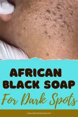 African Black Soap