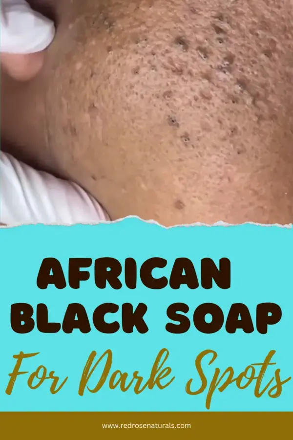 African Black Soap