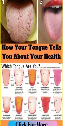 What Your Tongue Tells About Toxins In Your Body