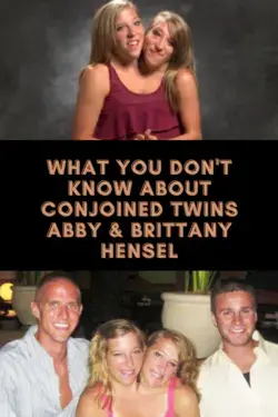 What You Don't Know About Conjoined Twins Abby & Brittany Hensel