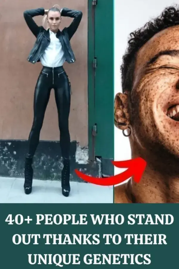 People Who Stand Out Thanks To Their Unique Genetics