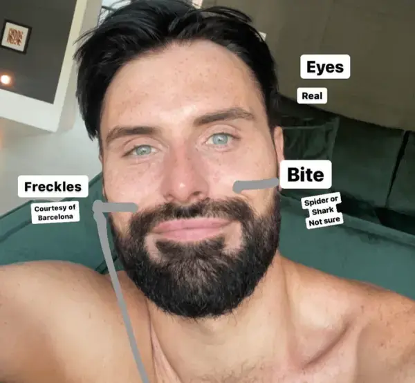 Rylan Clark rocks freckles in make-up and filter-free selfie to fans’ delight: ‘Absolutely stunning, hun’