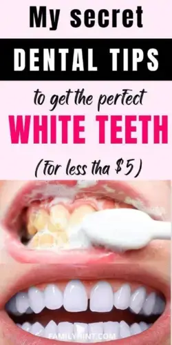 Teeth Whitening At Home In Just 3 Minutes || जादुई दांत सफेद करने का उपाय