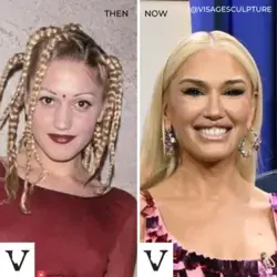Celebrity before and after: Gwen Stefani