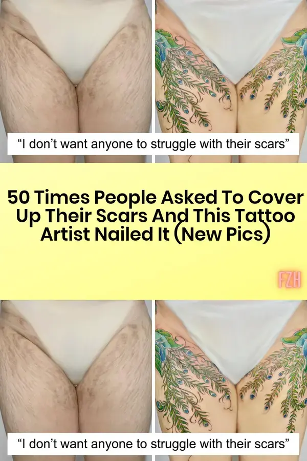 50 Times People Asked To Cover Up Their Scars, And This Tattoo Artist Nailed It (New Pics)