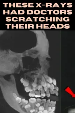 These X-Rays Had Doctors Scratching Their Heads