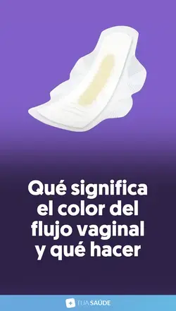 Qué significa el color del flujo vaginal y qué hacer