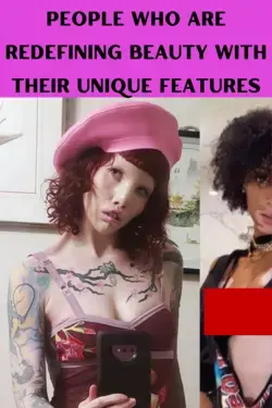 People Who Are Redefining Beauty With Their Unique Features