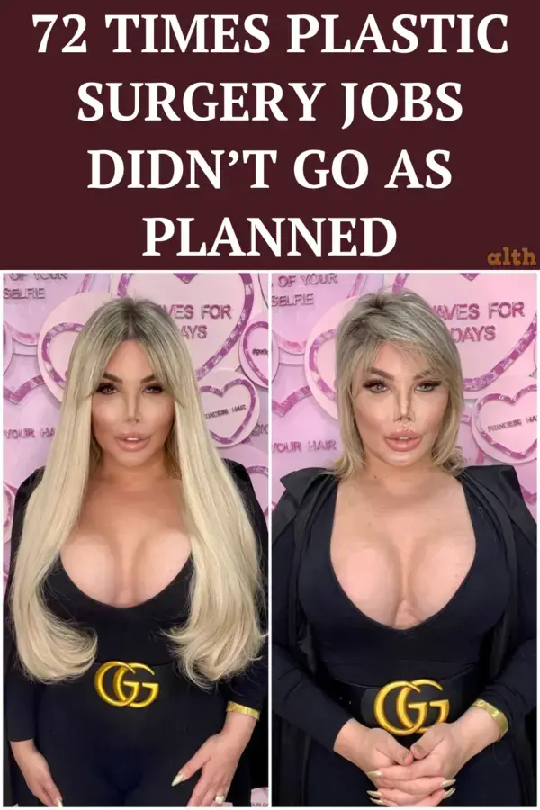 72 times plastic surgery jobs didn’t go as planned