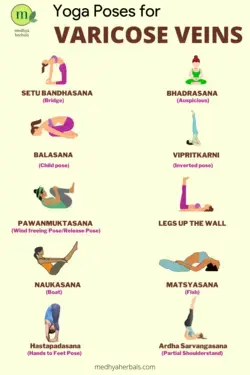 10 Yoga Poses to Prevent and Heal Varicose Veins Naturally