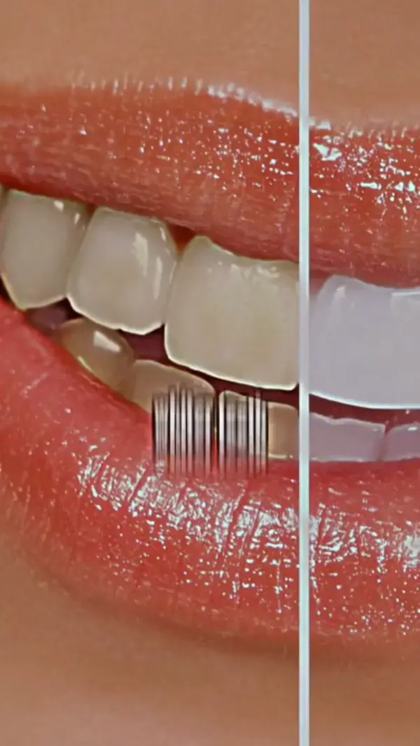 Teeth Cleaning, Teeth Whitening Hack, Oral Hygiene, Whiten Teeth at Home, Improve Oral Health