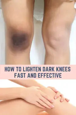Lighten Your Dark Knees Fast And Effective