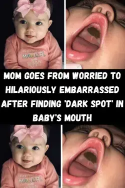 Mom goes from worried to hilariously embarrassed after finding 'dark spot' in baby's mouth