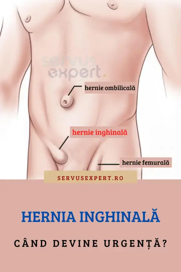 HERNIA INGHINALA: semne de alarmă, tratament