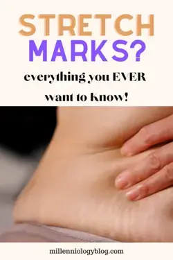 All the Questions (And Answers) You Want To Know About Stretch Marks During Pregnancy