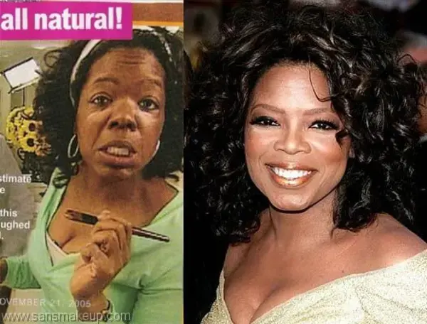 celebrityplasticsurgeryphotos.blogspot.com