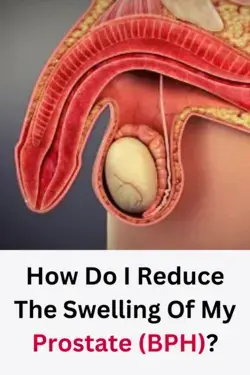 How to Avoid Prostate Swelling?